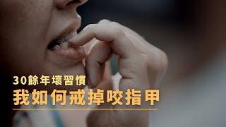 我如何戒掉咬指甲的壞習慣｜詳細步驟教學｜改掉30餘年的壞習慣