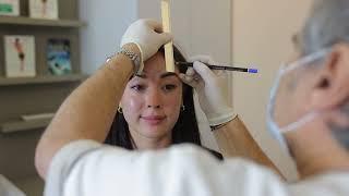 Dr Jules Nabet - Upper Face Botox, Anti-wrinkle injections, Forehead Lines, Chin Botox, Crows Feet