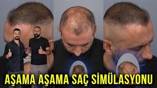 Aşama aşama saç simülasyonu işlemi - Uzm. Est. Semih DENİZ