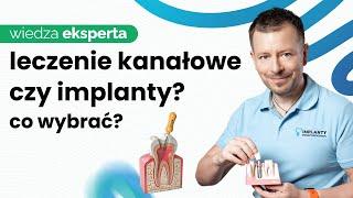 Leczenie Kanałowe a Implanty - Które Rozwiązanie Opłaca Się Lepiej?