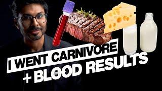 Why I'm Going Carnivore (1st Blood Tests Shown)