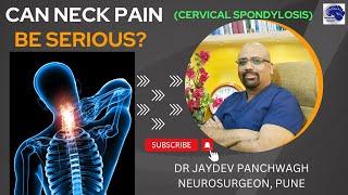 CERVICAL SPONDYLOSIS: cause of neck pain and headache. Dr Jaydev Panchwagh