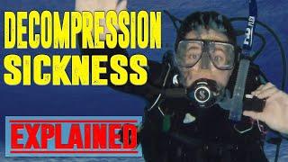 Decompression Sickness - The Bubbles You need to Worry About