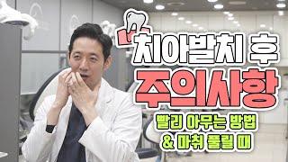 사랑니&임플란트 발치 후 통증, 음식섭취, 지혈 등 치아발치 주의사항 꿀팁들만 알려드립니다~!