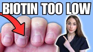 8 Biotin Deficiency Warning Signs NOT TO MISS | Hair, Skin, & Nails