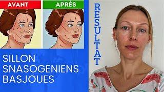 Basjoues et rides nasogéniens | Yoga du Visage | Facebuilding