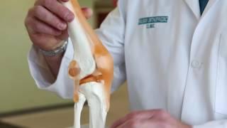 What is Runner’s Knee | Pain in knee when walking | Runners Knee Pain