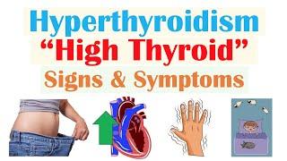 Hyperthyroidism & Thyroid Storm Signs & Symptoms (& Why They Occur)