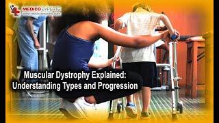 Muscular Dystrophy Explained: Understanding Types and Progression