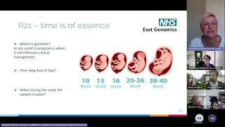 Genomics BITE - Rapid prenatal exome sequencing (R21): NHS East Genomics 26 September 2023