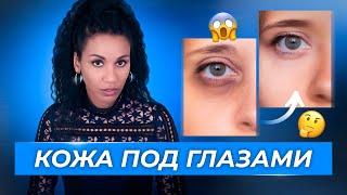 Как убрать тёмные круги и отёки под глазами? // Эффект панды: простой рецепт для осветления кожи