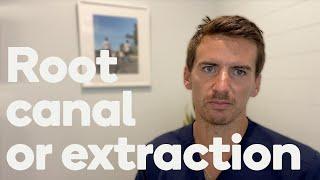 Root canals versus extractions