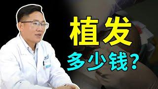 【植发问答】植发多少钱？了解清楚不怕被坑！雍禾植发|马晓阳医生