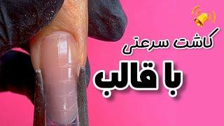 کاشت سرعتی با قالب و بیلدر