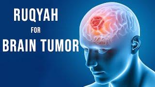 Ruqyah for Brain Tumor | Healing Through Listening - Ruqyah Helpline