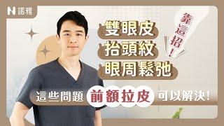 【前額拉皮案例分析】雙眼皮不能隨便做！ 眼睛無神 眉壓眼靠這招改善！李昱恆醫師｜諾雅整形外科