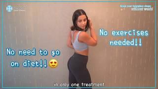 CoolShaping [Loss fat in a easy way] Trial $58@Perfect laser clinic