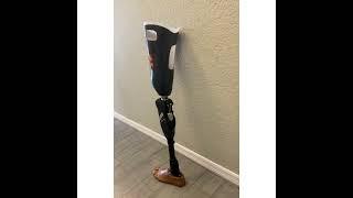 Look at this AK suction socket prosthesis with a Blatchford Linx microprocessor knee and ankle.