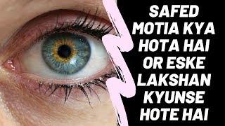 Safed Motia Kya Hota Hai | Safed Motia Ke Lakshan | Safed Motia Bind