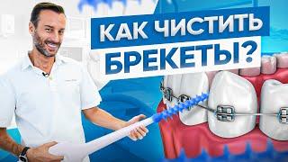 Как чистить зубы с брекетами? Разбираемся на реальном примере