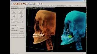 11   Superimposing two volumes  InVivoDental Training Videos