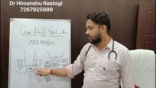 Fistula in ano easily cured by ksharsutra method, under MRI Fistulogram.