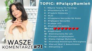 Palący Rumień | Wasze Komentarze#71