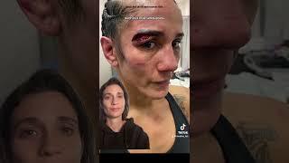 Did Katie Taylor rob Amanda Serrano? #boxing #miketyson #jakepaul #taylorserrano #fight