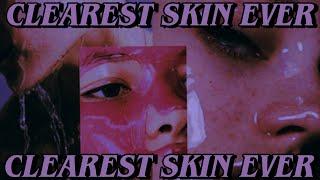 ️EXTREME   GET THE CLEAREST SKIN EVER! {powerful subliminal collab w/ @RoyAudios. }