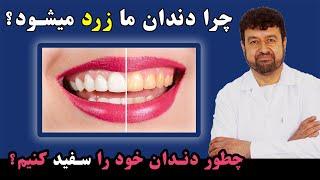 چرا داندان ها زرد میشود؟ | چطور میتوانیم دندان های خود را سفید کنیم؟ 🩸 داکترستان