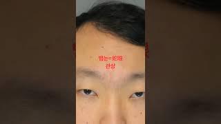 반드시 피해야 할 뱀눈 관상