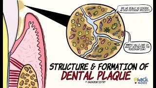 Dental Plaque: Structure and Formation