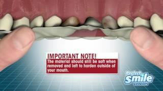 Perfect Smile Veneers Instructional - Getting Started