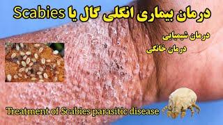 انواع روش‌های درمان بیماری #انگلی #گال، شیمیایی، گیاهی، خانگی Treatment of Scabies parasitic disease