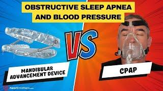 Obstructive Sleep Apnea & Blood Pressure | Mandibular Advancement Device Vs CPAP