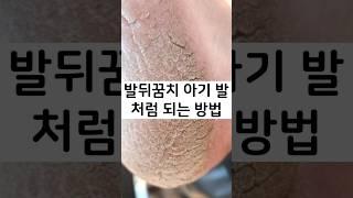 발뒤꿈치 아기 발처럼 되는 방법, 발뒤꿈치 갈라짐