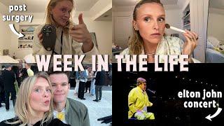 week in the life: recovering from surgery, trip to san diego, and lots of catching up