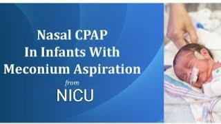 Today new born baby meconium aspiration care & treatment on cpap in Nicu ‍️