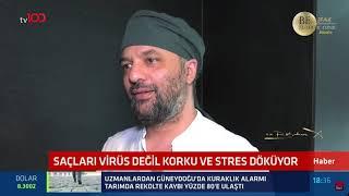 Tv100 Ana Haber Bir Uzman Görüşü Olarak Koronavirüs Ve Saç Dökülmesi Hakkında Görüşlerimizi Aldı