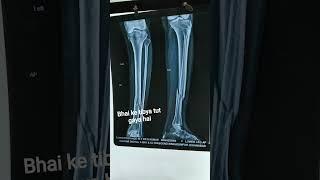 #dr vn singh Bones ke mbbs d ortho hai isko #oprationcobraevent #announcemnt #paramedicalinstit