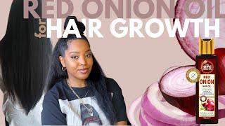 Onion Oil For Hair Growth | Natural Hair | Melissa Denise