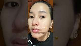 Akibat Rela pakai Merkuri.. Akhirnya Beralih !! #skincareviral