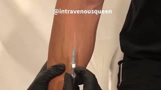 Prevent Veins From Blowing And Thumb Maneuver by Intravenous Queen