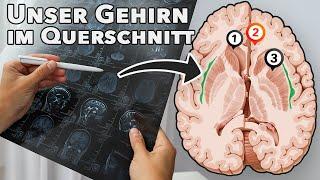 Das Gehirn im Querschnitt: alle wichtigen Strukturen