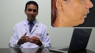 Preenchimento Labial, Odontologia, Estética, Harmonização orofacial , Leandro Vannutc