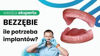 ILE IMPLANTÓW NAPRAWDĘ POTRZEBUJESZ, ABY ODZYSKAĆ PIĘKNY UŚMIECH?