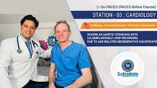 PACES 2023 New Format |Ss-PACES|Sample|Station-3|SEVERE AORTIC STENOSIS with ILR due to DC