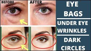 EYE REJUVENATION | FACE YOGA FOR EYE WRINKLES, PUFFY EYES, DARK CIRKLES, EYE BAGS