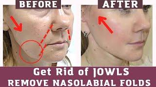 Anti Aging Exercises for Jowls |Nasolabial folds |Smile Lines| face yoga and massage