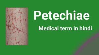 Petechiae/Medical term in hindi